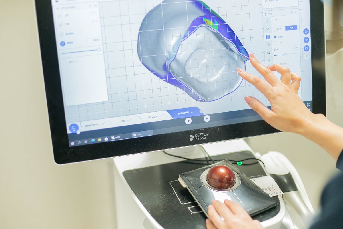 歯科技工士在中で納得いくまで歯をカスタマイズのイメージ