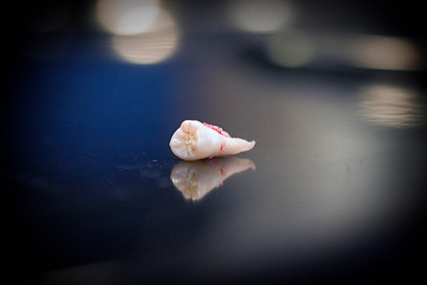 シンプルな形の歯